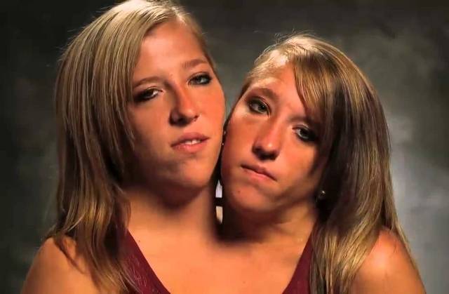 Conjoined twins Abby and Brittany Hensel the chances of survival for such  twins are usually very low but they live to aldulthood and become teachers  - iFunny Brazil