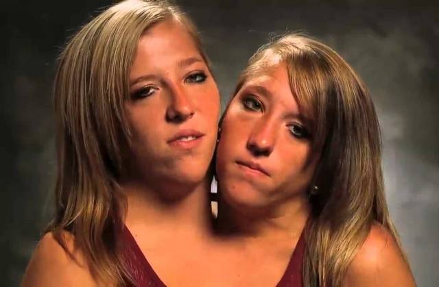 Mamamia - One body, two souls. The incredible lives of conjoined twins Abby and Brittany Hensel. hensel/